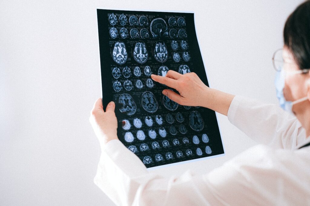 Doctor examining brain scans. Photo taken by Anna Shvet.